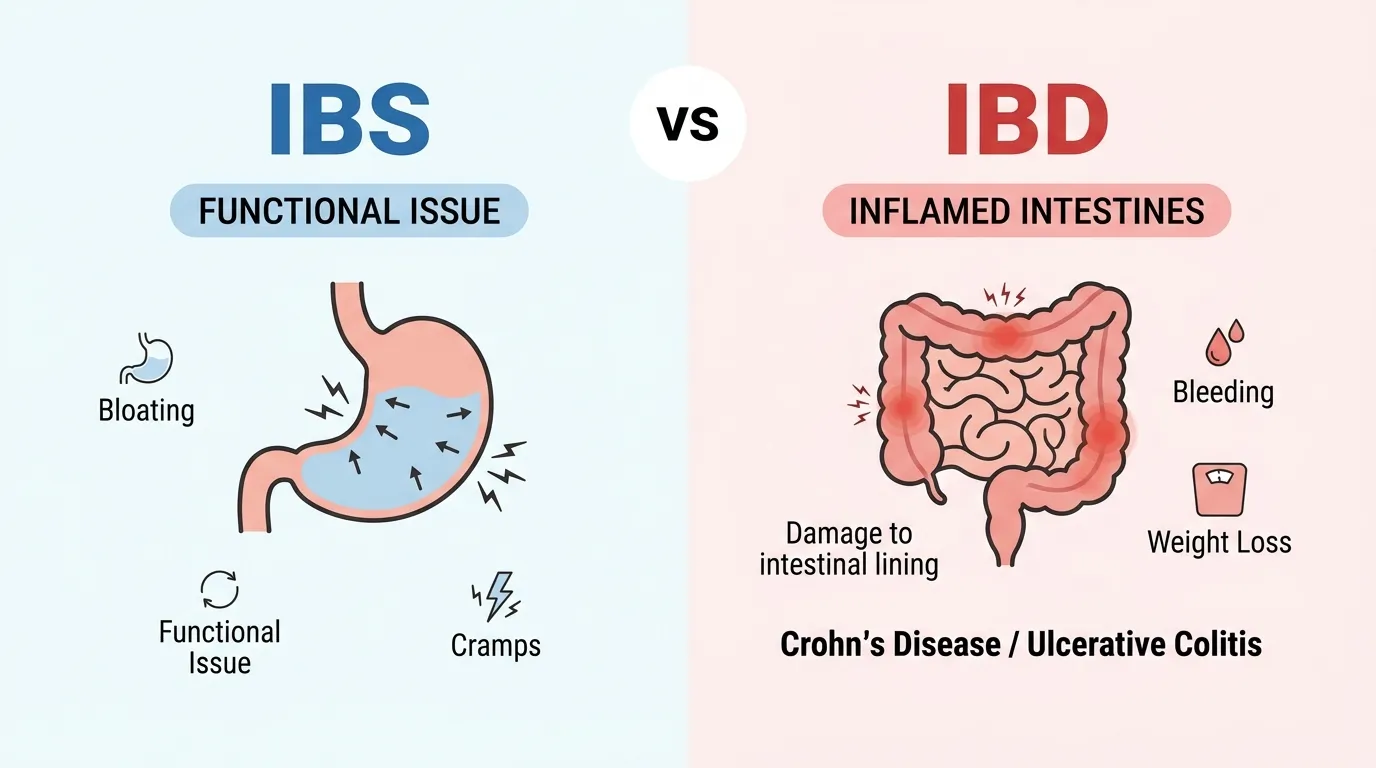 difference between ibs and ibd