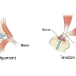 difference between ligament and tendon